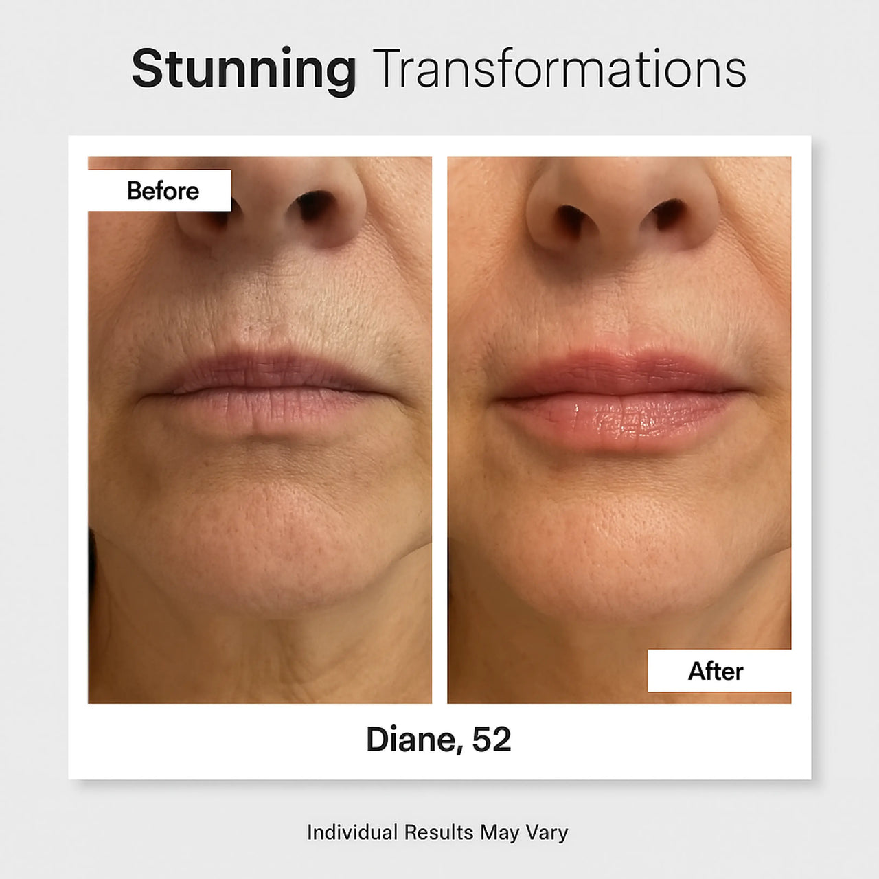 Perfect Pout Kit