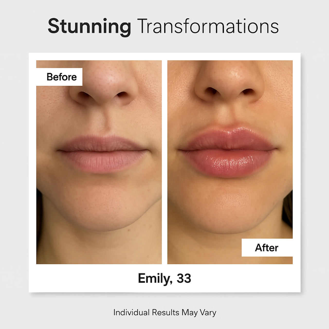 Perfect Pout Kit