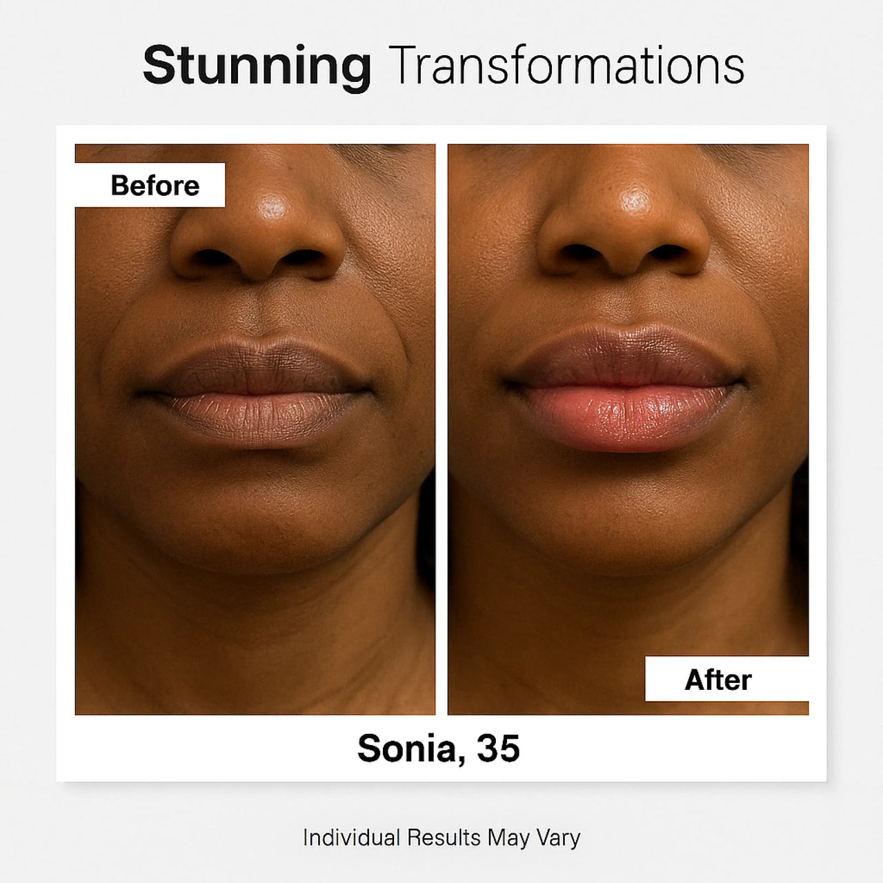 Perfect Pout Kit